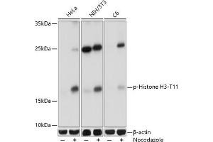 Western blot analysis of extracts of various cell lines, using Phospho-Histone H3-T11 antibody (ABIN3023615, ABIN3023616, ABIN3023617 and ABIN6225469) at 1:1000 dilution.