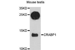 Western blot analysis of extracts of mouse testis, using CRABP1 antibody (ABIN6291540) at 1:3000 dilution.
