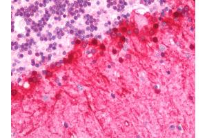 Human Brain, Cerebellum: Formalin-Fixed, Paraffin-Embedded (FFPE)
