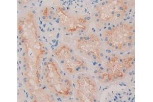 Figure. (QSOX1 antibody  (AA 394-519))