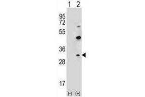Western blot analysis of CLDN2 (arrow) using rabbit polyclonal CLDN2 Antibody (pTyr195) . (Claudin 2 antibody  (C-Term))