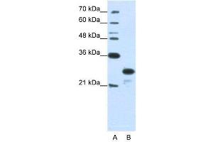 WB Suggested Anti-ANP32A  Antibody Titration: 1. (PHAP1 antibody  (N-Term))