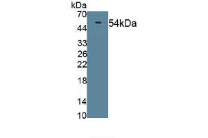 Detection of Recombinant LIPD, Mouse using Polyclonal Antibody to Lipoprotein lipase (LPL) (Lipoprotein Lipase antibody)