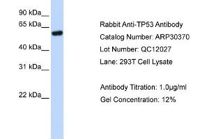 WB Suggested Anti-TP53 Antibody Titration: 0.
