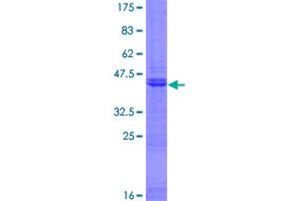 PHC3 Protein (AA 1-151) (GST tag)