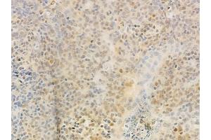 anti-Zinc Finger CCCH-Type Containing 11A (ZC3H11A) (C-Term) antibody
