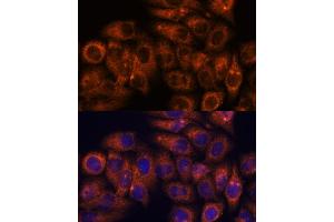 Immunofluorescence analysis of HeLa cells using STE antibody (ABIN7270588) at dilution of 1:100. (STEAP4 antibody  (AA 1-100))