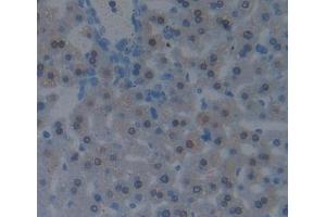 Used in DAB staining on fromalin fixed paraffin- embedded liver tissue (CBY1/PGEA1 antibody  (AA 7-127))