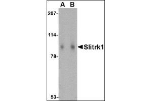 Western blot analysis of Slitrk1 in human brain tissue lysate with this product at (A) 1 and (B) 2 μg/ml. (SLITRK1 antibody  (Middle Region))