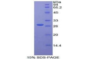 SDS-PAGE (SDS) image for Fibroblast Growth Factor Receptor Substrate 2 (FRS2) (AA 239-449) protein (His tag) (ABIN2124825)