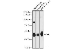 Western blot analysis of extracts of various cell lines using CKB Polyclonal Antibody at dilution of 1:3000. (CKB antibody)