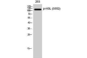 Western Blotting (WB) image for anti-Lipase, Hormone-Sensitive (LIPE) (pSer552) antibody (ABIN3182522) (LIPE antibody  (pSer552))