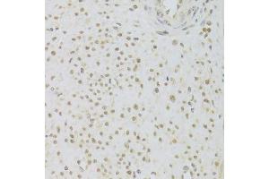 Immunohistochemistry of paraffin-embedded human leiomyoma of uterus using PRPF3 Antibody.