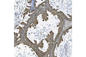 IHC analysis of TAF4 using anti-TAF4 antibody (ABIN7602114).