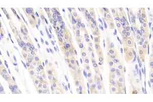 Detection of CCL1 in Mouse Stomach Tissue using Polyclonal Antibody to Chemokine C-C-Motif Ligand 1 (CCL1) (CCL1 antibody  (AA 24-92))