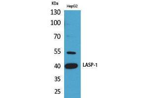 Western Blotting (WB) image for anti-LIM and SH3 Protein 1 (LASP1) (Internal Region) antibody (ABIN3187767) (LASP1 antibody  (Internal Region))
