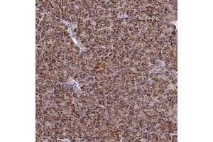 Immunohistochemical staining (Formalin-fixed paraffin-embedded sections) of human pancreas with ITGA2 polyclonal antibody  shows strong cytoplasmic positivity in exocrine glandular cells. (ITGA2 antibody  (AA 1032-1126))