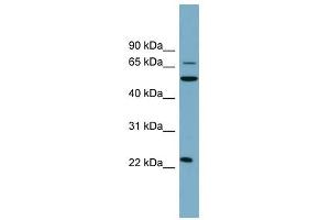 CLEC6A antibody used at 1 ug/ml to detect target protein. (C-Type Lectin Domain Family 6, Member A (CLEC6A) (N-Term) antibody)