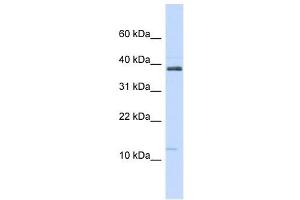 SPINK1 antibody used at 1 ug/ml to detect target protein.