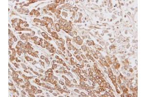 IHC-P Image Immunohistochemical analysis of paraffin-embedded MDA-MB468 xenograft, using NYD-SP26, antibody at 1:100 dilution. (CABS1 antibody  (Center))