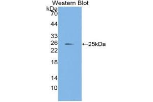 Western blot analysis of the recombinant protein. (Laminin alpha 1 antibody  (AA 41-230))