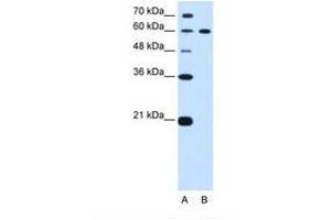 Image no. 1 for anti-Deltex Homolog 2 (DTX2) (AA 454-503) antibody (ABIN6739165) (DTX2 antibody  (AA 454-503))