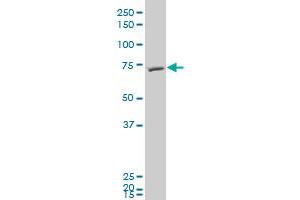 FBXL5 polyclonal antibody (A01), Lot # 051123JCS1 Western Blot analysis of FBXL5 expression in HepG2 . (FBXL5 antibody  (AA 584-691))