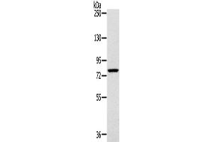 Western Blotting (WB) image for anti-Ribosomal Protein S6 Kinase, 90kDa, Polypeptide 1 (RPS6KA1) antibody (ABIN2424112) (RPS6KA1 antibody)