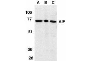 Western blot analysis of AIF in K562 cell lysate (A), rat heart (B), and mouse heart (C) tissue lysates with AP30030PU-N AIF antibody (IN) at 1 μg/ml.