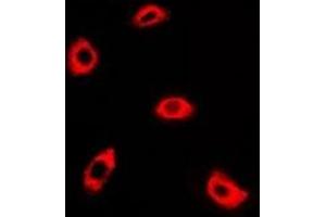 Immunofluorescent analysis of AK4 staining in A549 cells. (AK4 antibody)