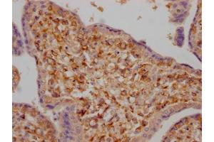 Immunohistochemistry (IHC) image for anti-Lysyl Oxidase-Like 2 (LOXL2) antibody (ABIN7127602)