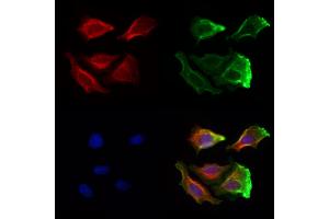 ABIN6260455 and ABIN6272989 staining Hela cells by IF/ICC.