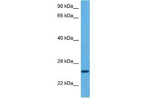 Host:  Rabbit  Target Name:  GSTA5  Sample Tissue:  Human Hela Whole Cell  Antibody Dilution:  1ug/ml (GSTa5 antibody  (Middle Region))
