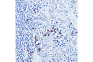 Immunohistochemistry of paraffin-embedded rat spleen using TLR9 Rabbit pAb (ABIN7270849) at dilution of 1:100 (40x lens). (TLR9 antibody  (AA 350-450))