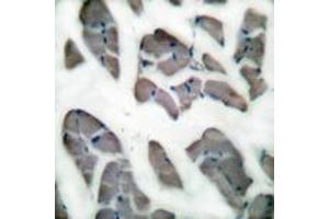 Immunohistochemistry (IHC) image for anti-Desmin (DES) (AA 421-470) antibody (ABIN2889184) (Desmin antibody  (AA 421-470))