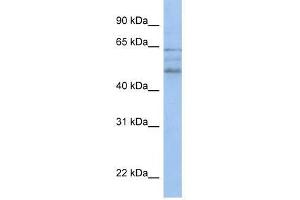 anti-Zinc Finger, MYND-Type Containing 17 (ZMYND17) (C-Term) antibody