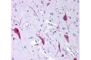 Anti-GRM4 / MGLUR4 antibody  ABIN1048936 IHC staining of human brain, neurons and glia.