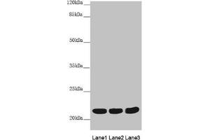Western blot All lanes: MYL3 antibody at 3. (MYL3/CMLC1 antibody  (AA 1-195))