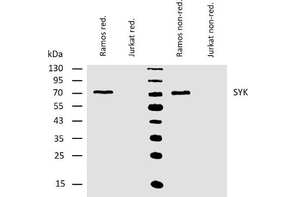 SYK antibody  (AA 5-360)