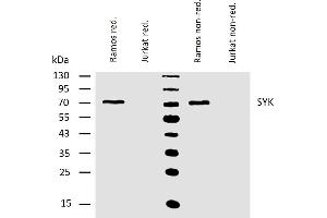 Western blotting analysis of human Syk using mouse monoclonal antibody SYK-01 on lysates of Ramos and Jurkat (negative control) cells under reducing and non-reducing conditions.