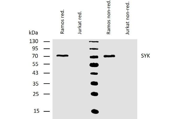 SYK 抗体  (AA 5-360)