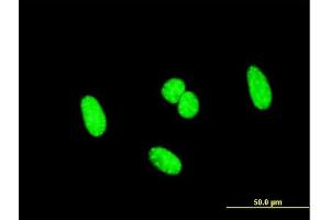 Immunofluorescence (IF) image for anti-Sex Comb On Midleg-Like 1 (SCML1) (AA 3-100) antibody (ABIN562803)