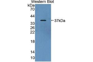 Figure. (CANT1 antibody  (AA 111-403))