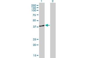 Western Blot analysis of DNMT3L expression in transfected 293T cell line by DNMT3L MaxPab polyclonal antibody. (DNMT3L antibody  (AA 1-386))