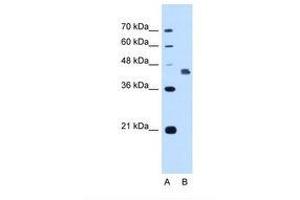 Image no. 2 for anti-Deafness, Autosomal Dominant 5 (DFNA5) (AA 342-391) antibody (ABIN321047) (DFNA5 antibody  (AA 342-391))