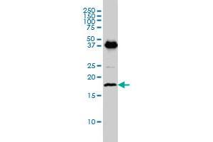 EMP3 monoclonal antibody (M01), clone 3D4 Western Blot analysis of EMP3 expression in C32 .