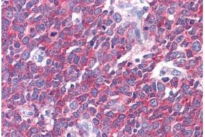 Human Tonsil: Formalin-Fixed, Paraffin-Embedded (FFPE) (LMTK2 antibody  (AA 1181-1280))