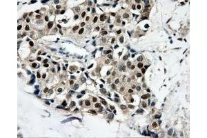 Immunohistochemical staining of paraffin-embedded thyroid tissue using anti-CAMK1Dmouse monoclonal antibody.