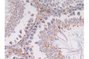 IHC-P analysis of Rat Intestine Tissue, with DAB staining. (IL-4 antibody  (AA 61-111))