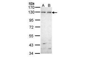 Image no. 1 for anti-EPH Receptor B6 (EPHB6) (AA 793-977) antibody (ABIN467545) (EPH Receptor B6 antibody  (AA 793-977))